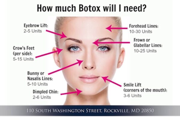 Where Not to Inject Botox?