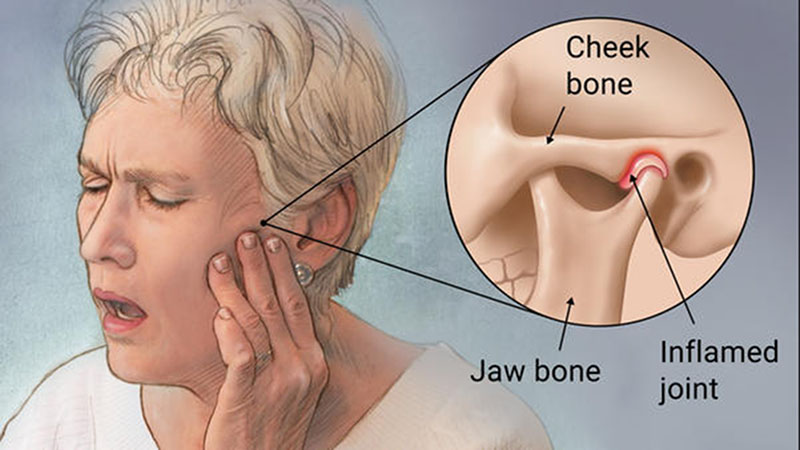 TMJ Disorder Symptoms