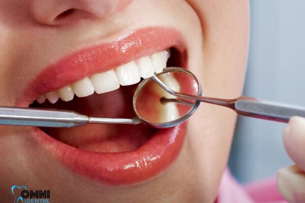 Untreated Dental Issues