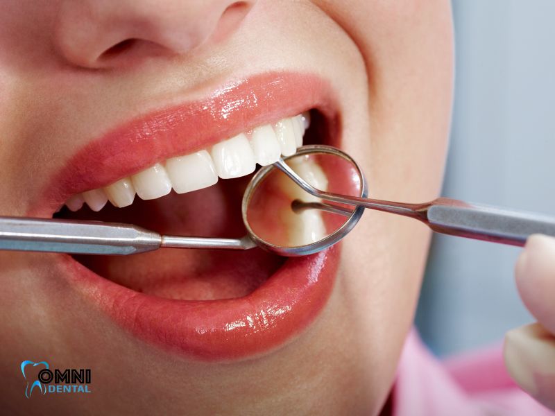 Untreated Dental Issues
