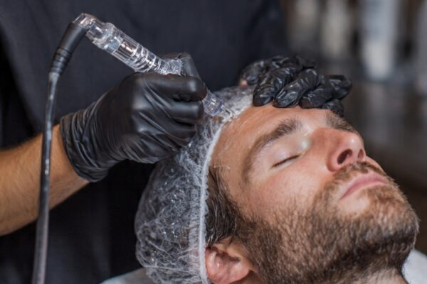 What to Expect During Hair Rejuvenation Treatments