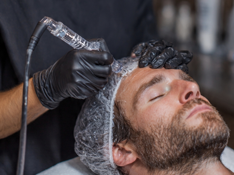 What to Expect During Hair Rejuvenation Treatments